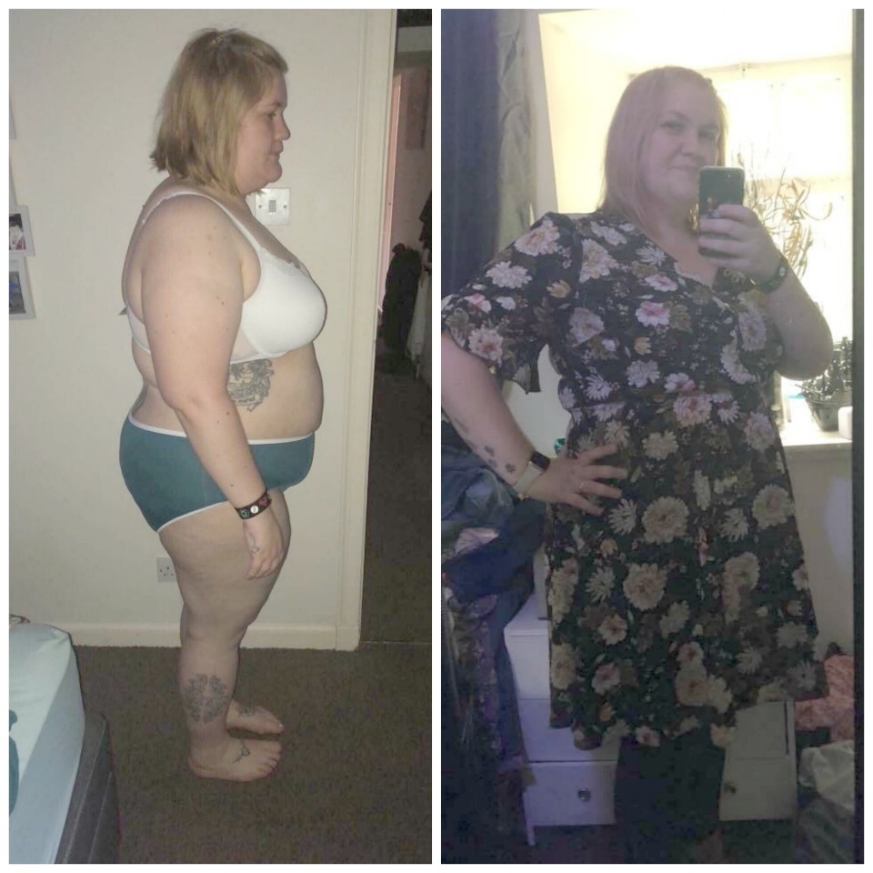 Charlie-Before-and-After-2