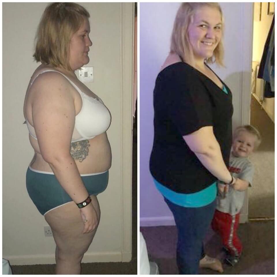 Charlie-before-and-after-