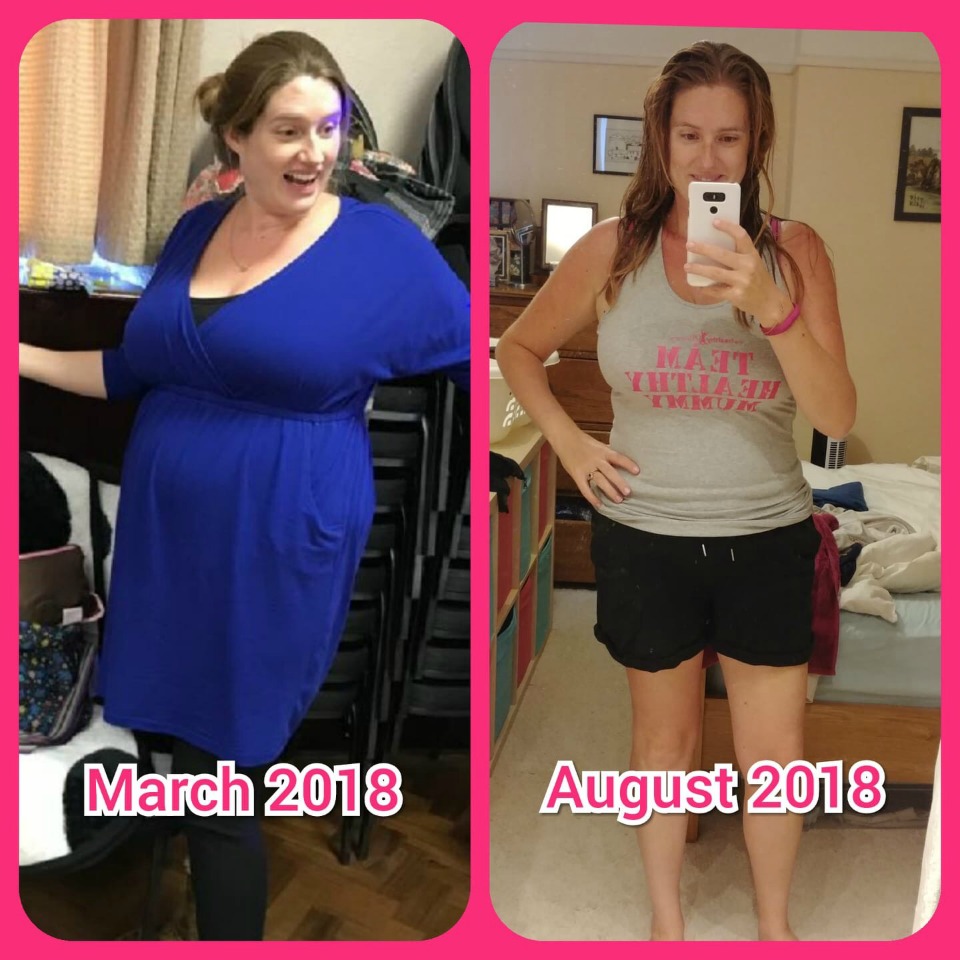 Kate-HernaÌndez-before-and-after