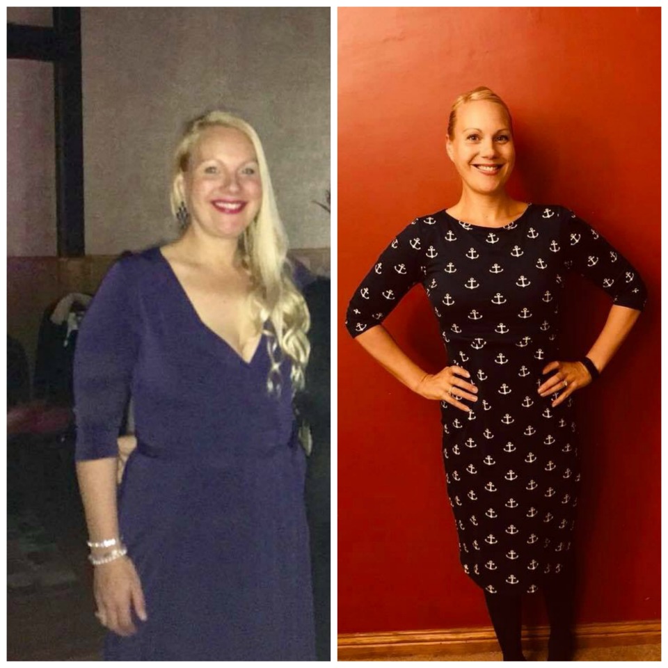 Siobhan-Before-and-After